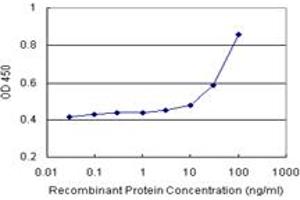 ALDH1A1 (Human) Matched Antibody Pair