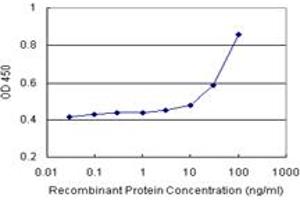 Sandwich ELISA detection sensitivity ranging from 10 ng/mL to 100 ng/mL. (ALDH1A1 (Humain) Matched Antibody Pair)