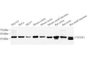 Western blot analysis of CYPIW1 (ABIN7073674) at dilution of 1: 1000 (CYP2W1 anticorps)
