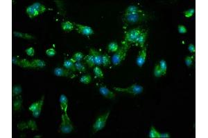 Immunofluorescence staining of Hela cells with ABIN7169102 at 1:100, counter-stained with DAPI. (NEK4 anticorps  (AA 516-661))