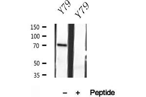 Western blot analysis of extracts of Y79 cells, using MPP5 antibody. (MPP5 anticorps  (C-Term))