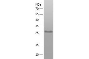 Western Blotting (WB) image for Erythrocyte Membrane Protein Band 4.1 Like 3 (EPB41L3) (AA 3-194) protein (His tag) (ABIN7122816)