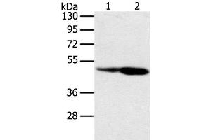Western Blot analysis of Hepg2 and hela cell using SNX8 Polyclonal Antibody at dilution of 1:400 (SNX8 anticorps)