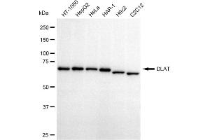 Western blotting analysis using DLAT antibody (ABIN7798336).
