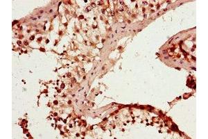 Immunohistochemistry of paraffin-embedded human testis tissue using ABIN7167262 at dilution of 1:100 (RAB25 anticorps  (AA 1-210))