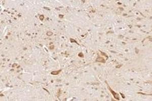Immunohistochemistry analysis of paraffin-embedded mouse cerebellum using,NCKAP1 (ABIN7074784) at dilution of 1: 8000