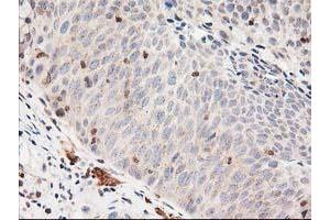 Image no. 1 for anti-LSM1 Homolog, U6 Small Nuclear RNA Associated (LSM1) antibody (ABIN1499210)