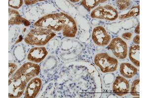 Immunoperoxidase of monoclonal antibody to FTCD on formalin-fixed paraffin-embedded human kidney.