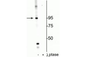 Western blot of HeLa cell lysate showing specific labeling of the ~95 kDa IR protein phosphorylated at Thr1160 in the first lane (-). (Insulin Receptor anticorps  (pThr1160))