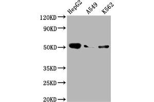 Western Blot Positive WB detected in: HepG2 whole cell lysate, A549 whole cell lysate, K562 whole cell lysate All lanes: Factor IX antibody at 1:2000 Secondary Goat polyclonal to rabbit IgG at 1/50000 dilution Predicted band size: 52 kDa Observed band size: 52 kDa (Recombinant Coagulation Factor IX anticorps)