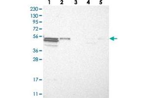Western blot analysis of Lane 1: RT-4, Lane 2: U-251 MG, Lane 3: Human Plasma, Lane 4: Liver, Lane 5: Tonsil with TRIM11 polyclonal antibody  at 1:250-1:500 dilution. (TRIM11 anticorps)