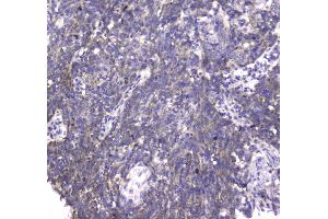IHC analysis of MRE11 using anti-MRE11 antibody .