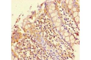 Immunohistochemistry of paraffin-embedded human colon tissue using ABIN7163147 at dilution of 1:100 (PEBP4 anticorps  (AA 23-227))