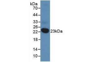 Western blot analysis of recombinant Human DUSP3. (Dual Specificity Phosphatase 3 (DUSP3) (AA 2-185) anticorps)