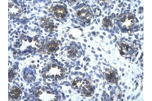 Rabbit Anti-SLC1A2 Antibody       Paraffin Embedded Tissue:  Human alveolar cell   Cellular Data:  Epithelial cells of renal tubule  Antibody Concentration:   4.