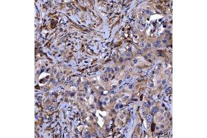 IHC analysis of Septin 11/SEPTIN11 using anti-Septin 11/SEPTIN11 antibody (ABIN7602925). (Septin 11 anticorps  (C-Term))