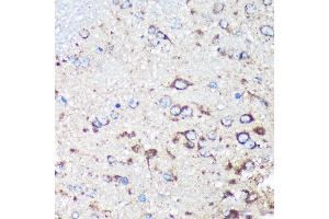 Immunohistochemistry of paraffin-embedded Rat brain using STNL Rabbit pAb (ABIN7270585) at dilution of 1:100 (40x lens). (STARD3NL anticorps  (AA 185-234))
