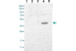 Western blot analysis of Lane 1: RT-4 Lane 2: U-251 MG Lane 3: Human Plasma Lane 4: Liver Lane 5: Tonsil with C3orf33 polyclonal antibody ( Cat # PAB27996 ) at 1:100 - 1:250 dilution. (C3orf33 anticorps)