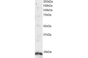 ABIN184801 staining (2µg/ml) of Human Testis lysate (RIPA buffer, 30µg total protein per lane). (ARL4A anticorps  (N-Term))