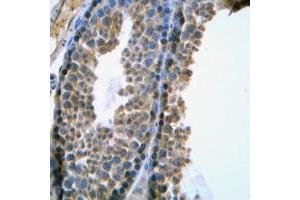 Immunohistochemical analysis of SRY staining in human testis formalin fixed paraffin embedded tissue section. (SRY anticorps  (Center))