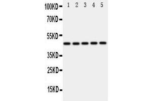 Western Blotting (WB) image for anti-Interferon Regulatory Factor 3 (IRF3) (AA 409-427), (C-Term) antibody (ABIN3043039) (IRF3 anticorps  (C-Term))