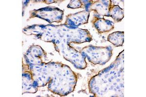 Anti- TFRC antibody,IHC(P) IHC(P): Human Placenta Tissue (Transferrin Receptor anticorps  (AA 1-198))