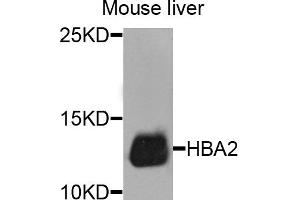 Western blot analysis of extracts of mouse liver cells, using HBA2 antibody. (HBa2 anticorps)