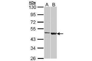WB Image Sample (30 ug of whole cell lysate) A: H1299 B: Raji 10% SDS PAGE antibody diluted at 1:1000 (GAL3ST1 anticorps)