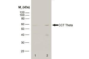 Western blot analysis of HeLa whole cell lysate (1) and HeLa heat stressed whole cell lysate (2) probed with RAT ANTI CCT THETA (ABIN119785) followed by F(ab')2 RABBIT ANTI RAT IgG:HRP (ABIN121399). (CCT8 anticorps)