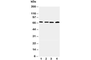 Western blot testing of IRAK2 antibody and Lane 1:  22RV