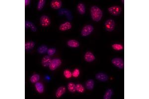 Immunofluorescence (IF) image for anti-Antigen Identified By Monoclonal Antibody Ki-67 (MKI67) (AA 1200-1250) antibody (ABIN7448915) (Recombinant Ki-67 anticorps  (AA 1200-1250))