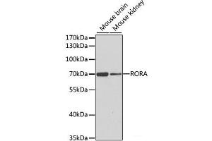 Western blot analysis of extracts of various cell lines using RORA Polyclonal Antibody at dilution of 1:1000. (RORA anticorps)