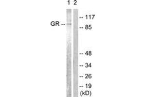 Western Blotting (WB) image for anti-Nuclear Receptor Subfamily 3, Group C, Member 1 (Glucocorticoid Receptor) (NR3C1) (AA 201-250) antibody (ABIN2888632)