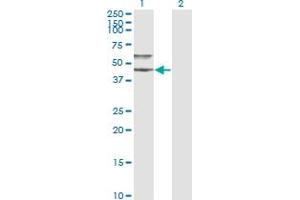 Western Blot analysis of SERPINA3 expression in transfected 293T cell line by SERPINA3 monoclonal antibody (M01), clone 1E6.