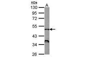Image no. 1 for anti-Neutrophil Cytosol Factor 1 (NCF1) (AA 1-228) antibody (ABIN1501901) (NCF1 anticorps  (AA 1-228))