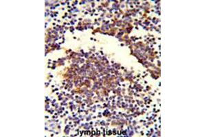 Formalin-fixed and paraffin-embedded human lymph tissue reacted with C7 Antibody (Center), which was peroxidase-conjugated to the secondary antibody, followed by DAB staining.