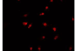 ABIN6269390 staining A-431 cells by IF/ICC. (Aurora Kinase B anticorps)