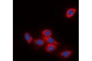 Immunofluorescent analysis of DOK2 staining in HeLa cells. (DOK2 anticorps)