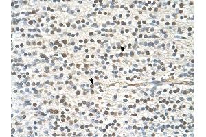 GAPVD1 antibody was used for immunohistochemistry at a concentration of 4-8 ug/ml. (GAPVD1 anticorps  (N-Term))
