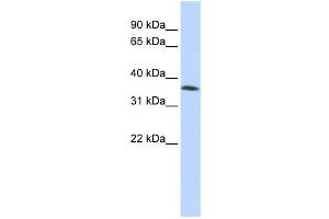 Western Blotting (WB) image for anti-Family with Sequence Similarity 164, Member A (FAM164A) antibody (ABIN2457929) (FAM164A anticorps)