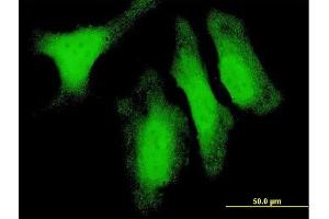 Immunofluorescence of monoclonal antibody to DUSP14 on HeLa cell.