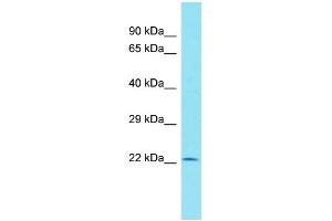 Host: Rabbit Target Name: C11orf40 Sample Type: Hela Whole cell lysates Antibody Dilution: 1. (C11orf40 anticorps  (N-Term))