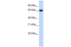 WB Suggested Anti-GTPBP2 Antibody Titration:  0. (GTPBP2 anticorps  (N-Term))