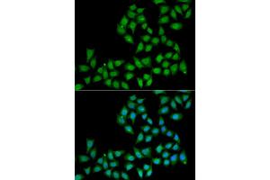 Immunofluorescence analysis of A549 cell using ELF1 antibody. (ELF1 anticorps)