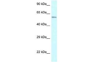 Western Blot showing CYP2U1 antibody used at a concentration of 1 ug/ml against Jurkat Cell Lysate (CYP2U1 anticorps  (Middle Region))