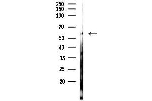 anti-phosphoglycerate Dehydrogenase (PHGDH) (N-Term) antibody