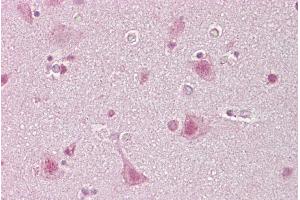 Immunohistochemistry (IHC) image for anti-Sterol Regulatory Element Binding Transcription Factor 1 (SREBF1) (Middle Region) antibody (ABIN2792233)