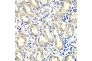 Immunohistochemistry of paraffin-embedded mouse kidney using PTGES2 antibody.