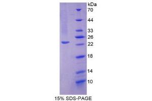 SDS-PAGE (SDS) image for Superoxide Dismutase 2, Mitochondrial (SOD2) (AA 25-222) protein (His tag) (ABIN1080864) (SOD2 Protein (AA 25-222) (His tag))
