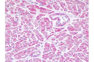 Anti-NDUFV1 antibody IHC staining of human heart.